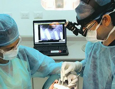 Разширяването на челюстта при деца и възрастни апарати и методи