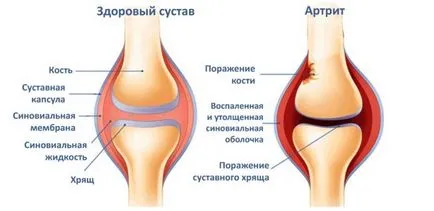 Болка в съвместните причините коляното и възможности за лечение