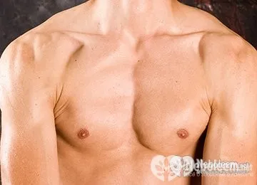 Gynecomastia - okai, tünetei, diagnózisa, kezelése