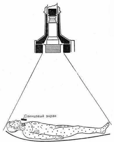 A tanulmány a jód anyagcsere által az egész test radiometria - radionuklid tanulmányok