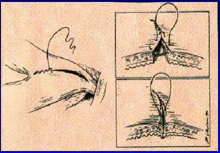 Cesarean-secțiunea de pisici