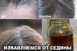 Szúrós szürke haj alkalmazás jellemzői