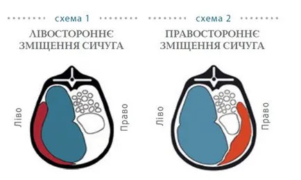 Контрол на абомасума изместване на крави