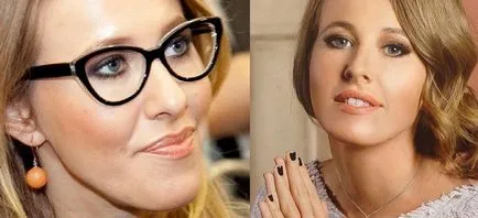 Ksenia Sobchak fotografie înainte și după rinoplastie, mandibuloplastiki si alte chirurgie plastica