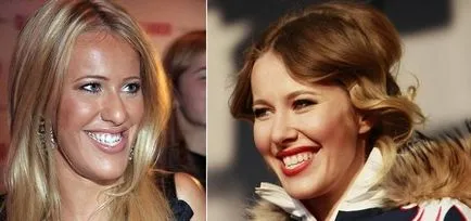 Ksenia Sobchak fotografie înainte și după rinoplastie, mandibuloplastiki si alte chirurgie plastica