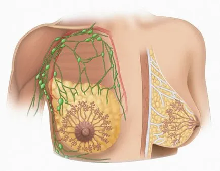 Lactostasis - portalul medical EUROLAB