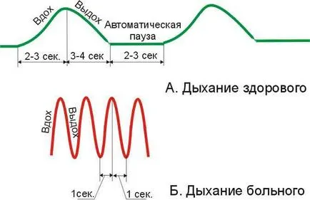 Metoda Buteyko