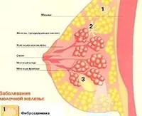 Функцията на млечната жлеза, структура, симптомите и лечението