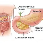 Húsleves csípő, hogyan kell főzni a népi orvosság recept