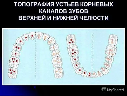 Представяне на лекция механична обработка на коренови канали