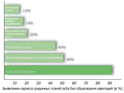 Устройството за диагностициране на ранните и скрити кариес diagnodent писалка 2190 Kavo