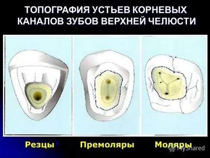 Представяне на лекция механична обработка на коренови канали