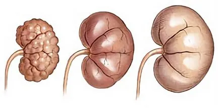 Megelőzése pancreatitis milyen szabályokat kell követni