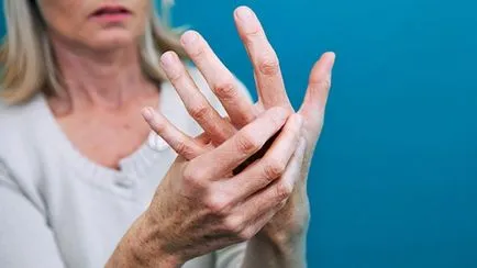 A rheumatoid arthritis és a kezelési lehetőségek külföldön