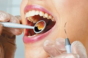 Cystotomy - зъб киста третиране