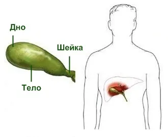 Deformáció az epehólyag egy kanyarban