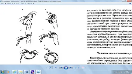 10) În cazul în care un garou aplicat corect, sângerarea arterială este oprit, pulsul periferic