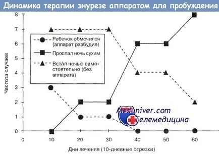 Шайба-нагоре в лечението на напикаване при деца и юноши