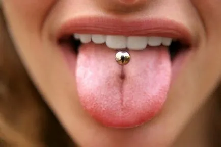 Hogyan lehet eltávolítani a tumort a nyelv piercing után