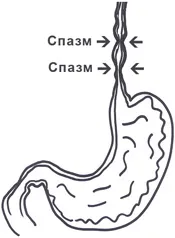 Дискинезия хранопровода симптоми и лечението