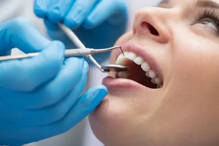 Ако искате да почистите зъбите от зъбен камък, моля, свържете се с нашия стоматология