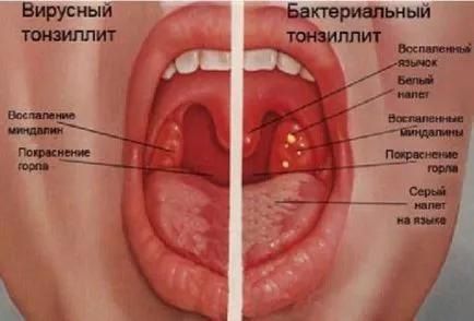 gât roșu și inflamat decât vindecarea