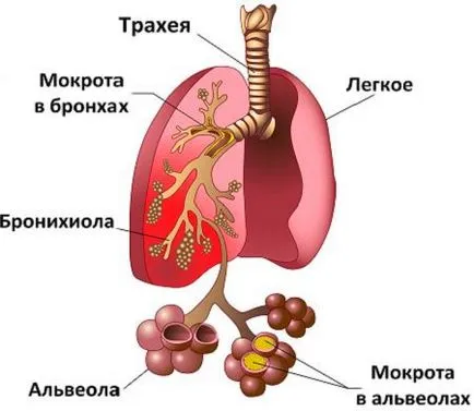 Reverzibilis bronchitis fajok és különösen kezelési módszerek