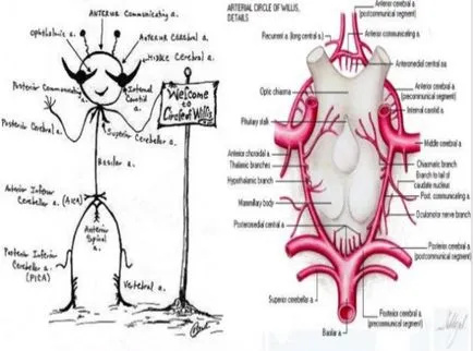 Accident vascular cerebral si anevrism este diferența