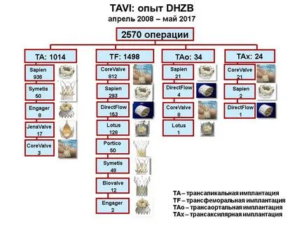 Имплантирането на сърдечни клапи