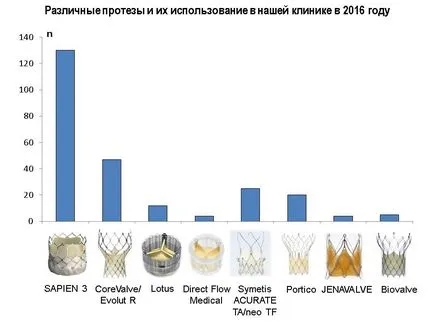 Имплантирането на сърдечни клапи