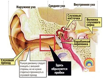 Как правилно да се почисти ушите