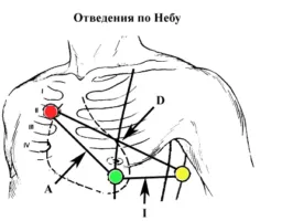 EKG az égen, és a kinevezési eljárás a felmérés