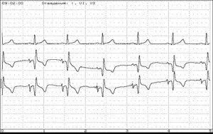 EKG az égen, és a kinevezési eljárás a felmérés