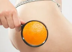 Hogyan lehet eltávolítani a narancsbőr a lábak