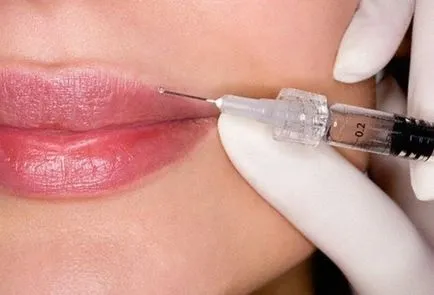 Hogyan lehet eltávolítani a hialuronsav ajkáról - készítmények és eljárások