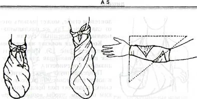 Triunghiulara bandaj - studopediya