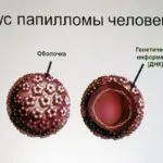 Tratamentul și prevenirea verucilor plane copil