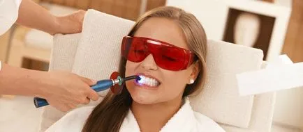 Лазерно избелване на зъби - каква е тя противопоказания, алтернатива