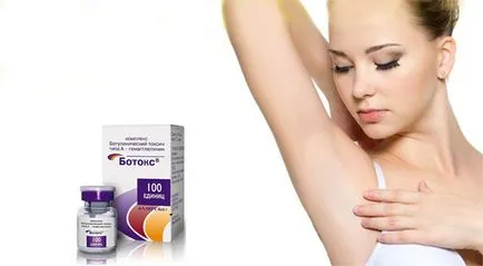 Kezelése hyperhidrosis Botox, Dysport