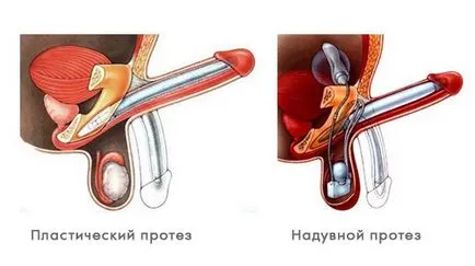 Tratamentul impotenței la bărbați de peste 50 de abordări majore și reguli