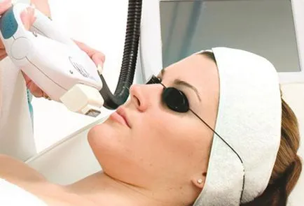 Лазерно почистване на лицето - модерен метод за ефективно подмладяване