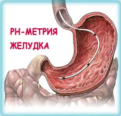 indus de medicamente gastrita (officinalis gastrita)