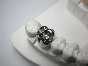 coroane dentare metalice la Moscova, producerea de proteze metalice pe dinti la preturi mici