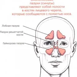 Мога ли да се затопли носа в затоплянето на синусите, като начин за лечение на синузит, всички от синузит