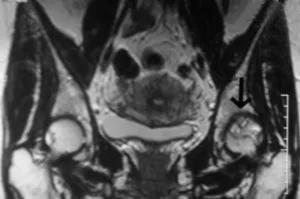 MRI a csípő ízületek és az ár, ahol az MRI csípőízület Szentpéterváron