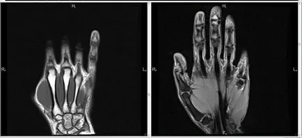 MRI на описанието ръка, цена, отзиви, снимки