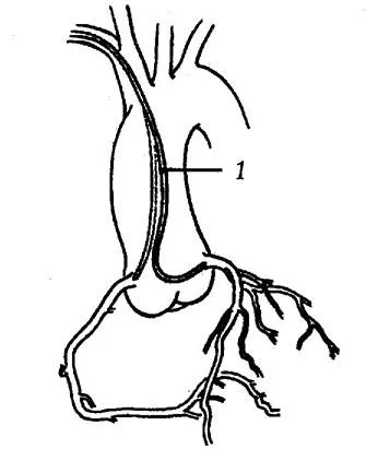 Gyógyszermentes kezelés, az aritmiák kezelésében és ingerületvezetési, cardioschool