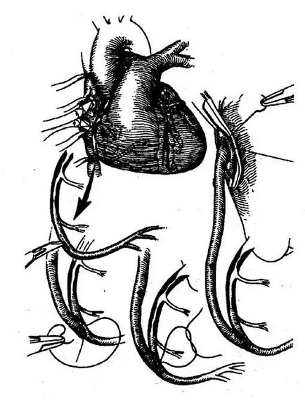 Gyógyszermentes kezelés, az aritmiák kezelésében és ingerületvezetési, cardioschool