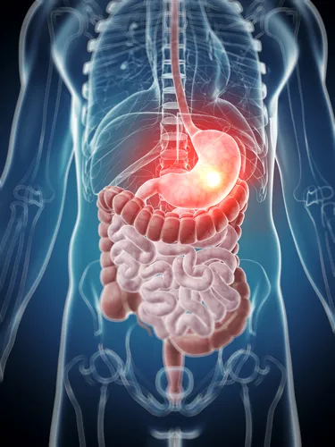 Egy új gyógyszer kezelésére a Crohn-betegség ígéretes eredményeket mutattak