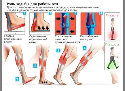 Имате ли нужда от ходене с разширени вени и какво му е доброто